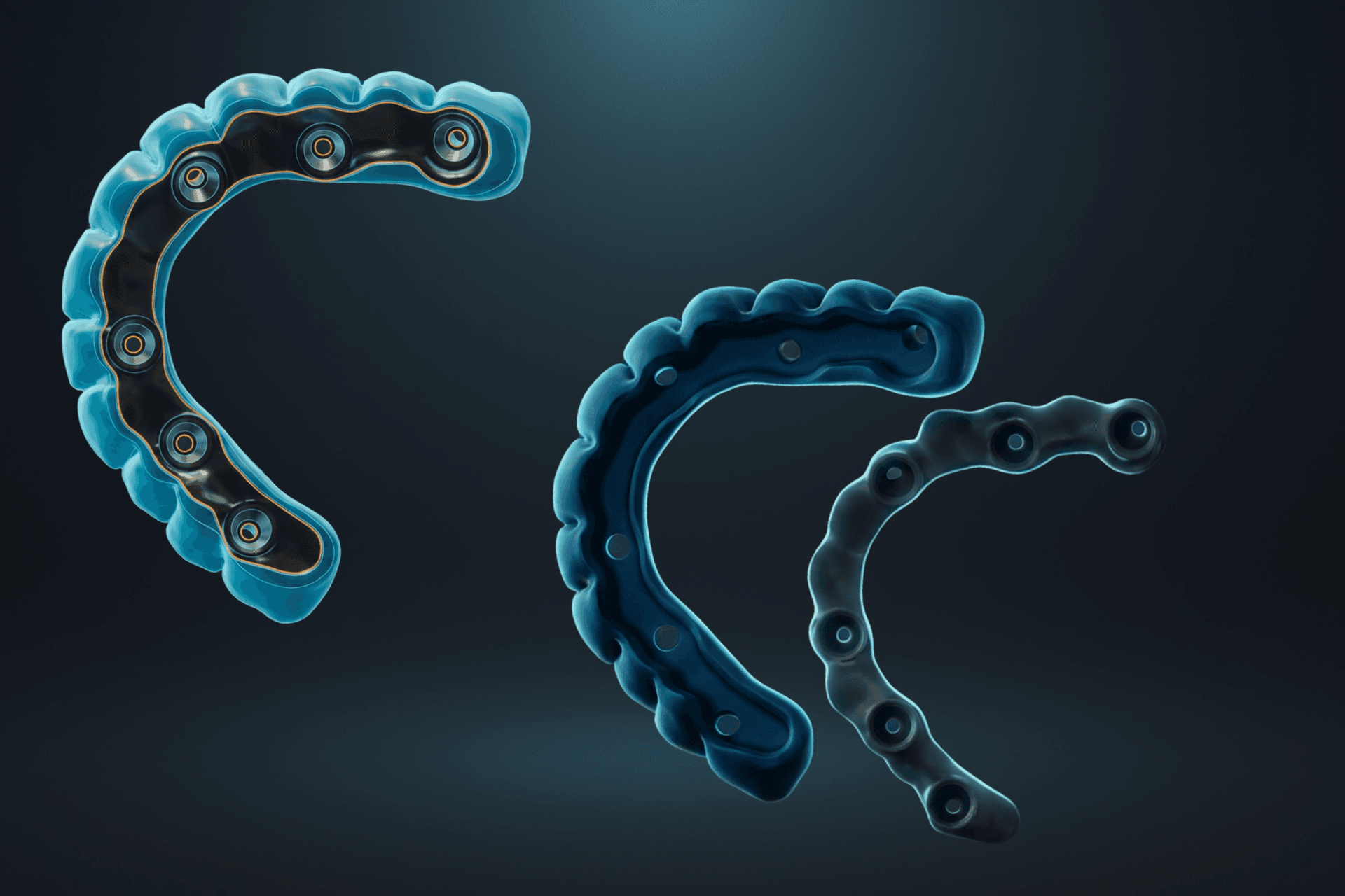 Diseño IBAR digital para rehabilitación sobre implantes - DigiDent
